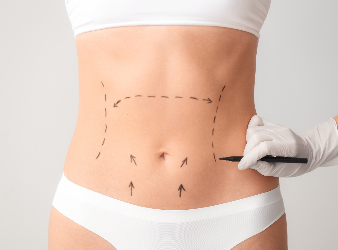 Foto de Cirurgia Plástica Não Deu o Resultado Esperado? Os 7 Motivos Reais Por Trás de Resultados Frustrantes