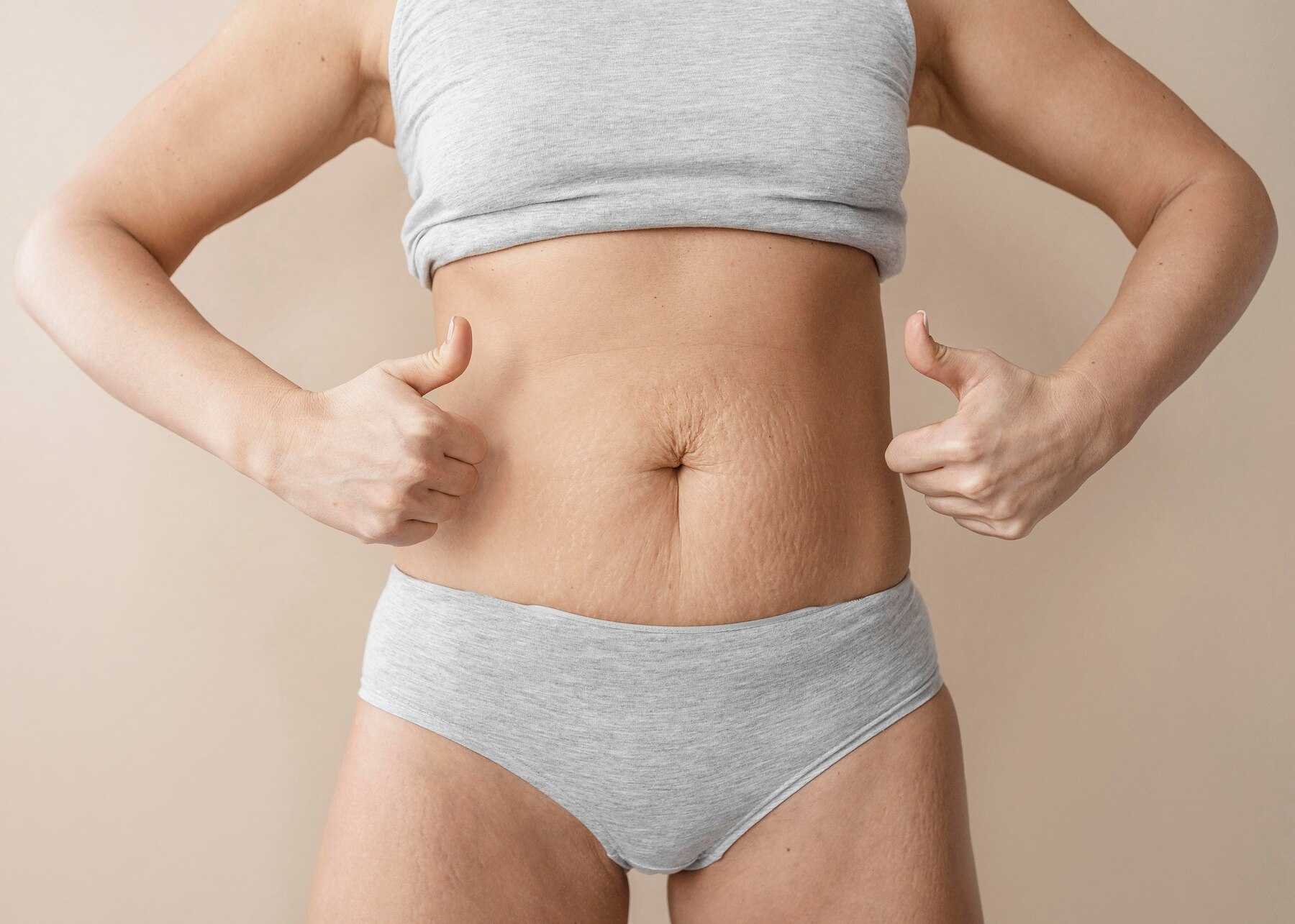 Imagem do procedimento Abdominoplastia Pós-Bariátrica